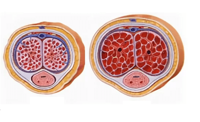 lipofilling za povećanje penisa
